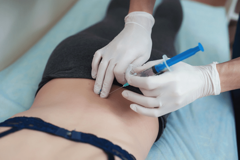 blokaad nimmepiirkonna osteokondroosi korral